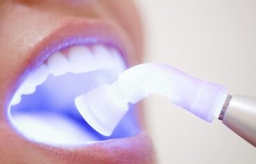 Laser Dental Treatment