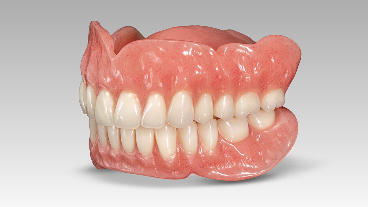 CAD-CAM Complete dentures in one Day - Dr Ajith Soman's Cosmetic Dental ...