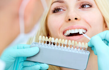 Tooth colored teeth restoration